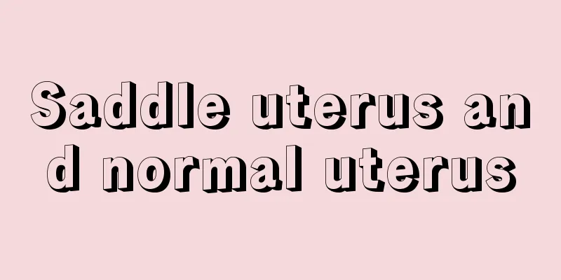 Saddle uterus and normal uterus