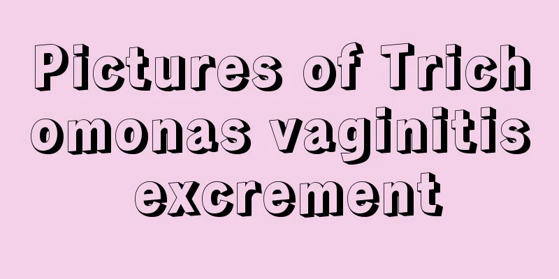 Pictures of Trichomonas vaginitis excrement