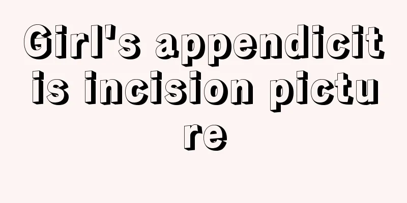 Girl's appendicitis incision picture