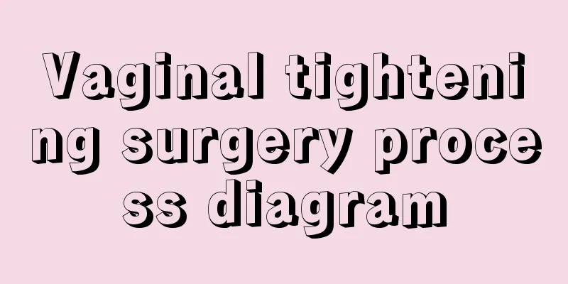 Vaginal tightening surgery process diagram