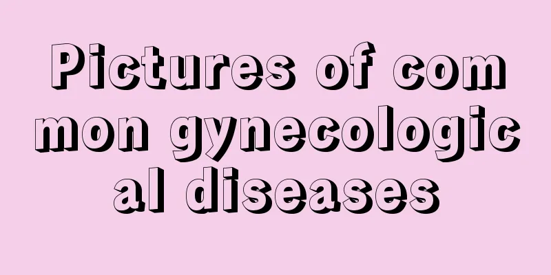 Pictures of common gynecological diseases