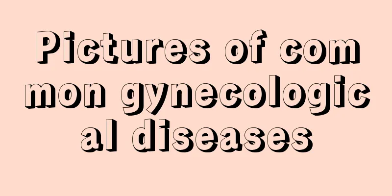 Pictures of common gynecological diseases