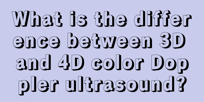 What is the difference between 3D and 4D color Doppler ultrasound?