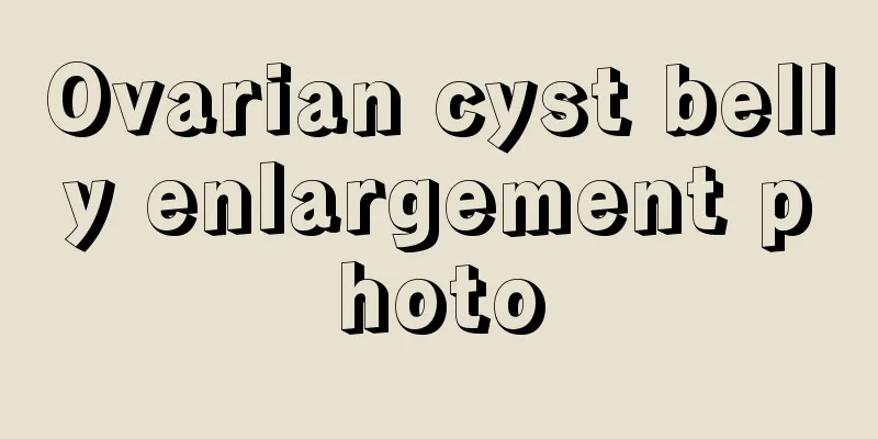 Ovarian cyst belly enlargement photo