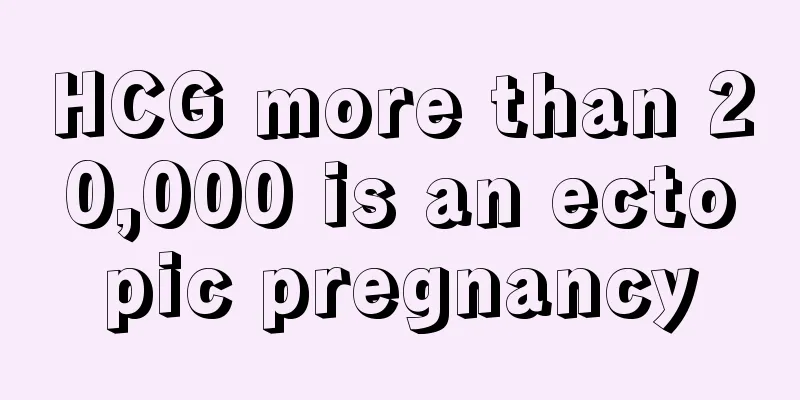 HCG more than 20,000 is an ectopic pregnancy