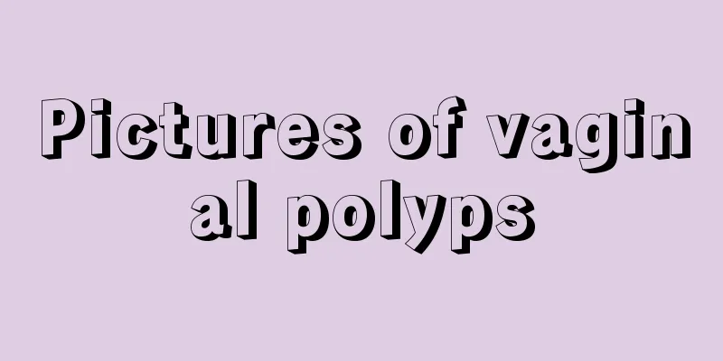 Pictures of vaginal polyps