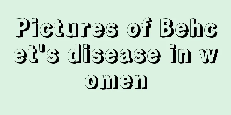 Pictures of Behcet's disease in women