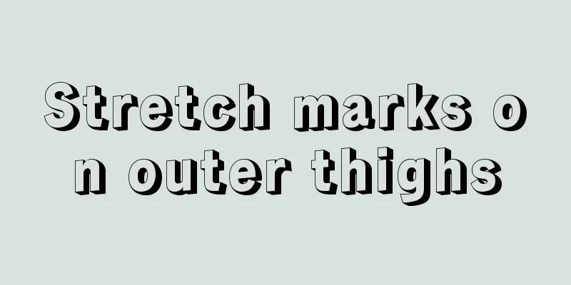 Stretch marks on outer thighs