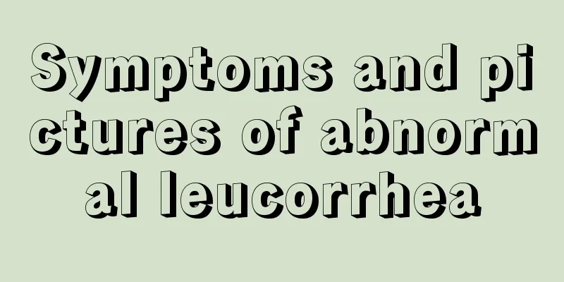 Symptoms and pictures of abnormal leucorrhea