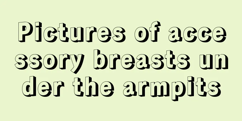 Pictures of accessory breasts under the armpits