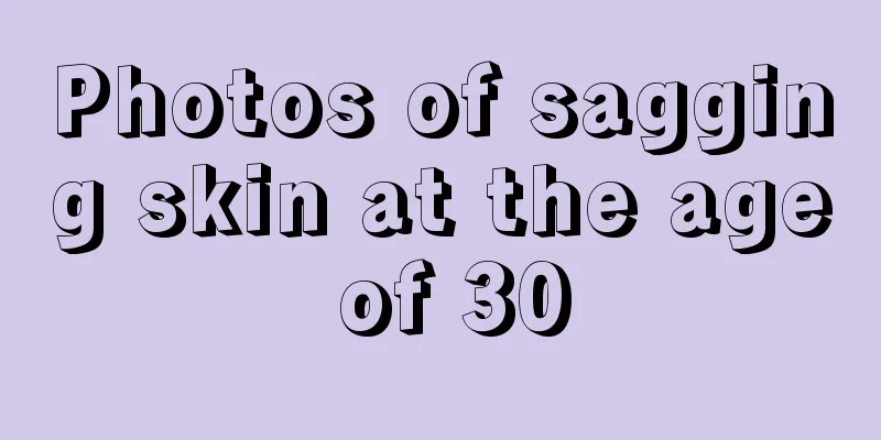 Photos of sagging skin at the age of 30