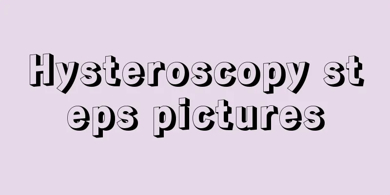 Hysteroscopy steps pictures