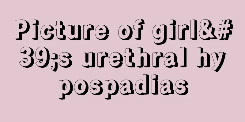 Picture of girl's urethral hypospadias