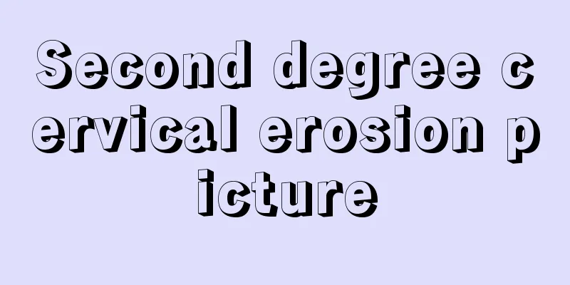 Second degree cervical erosion picture