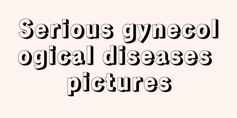 Serious gynecological diseases pictures