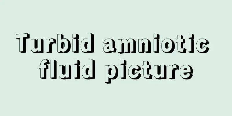 Turbid amniotic fluid picture