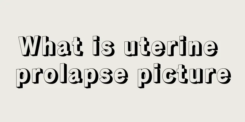 What is uterine prolapse picture