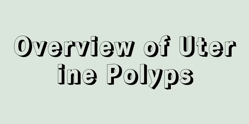 Overview of Uterine Polyps