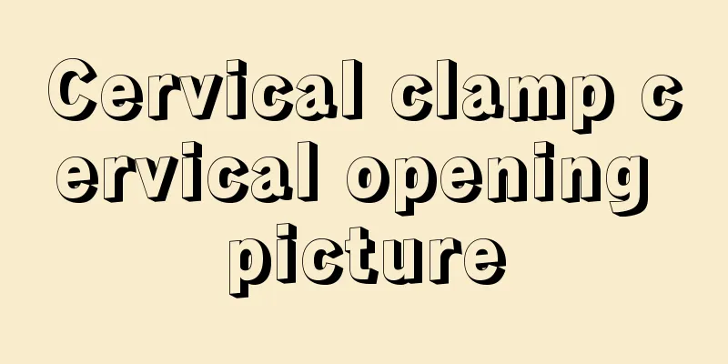 Cervical clamp cervical opening picture