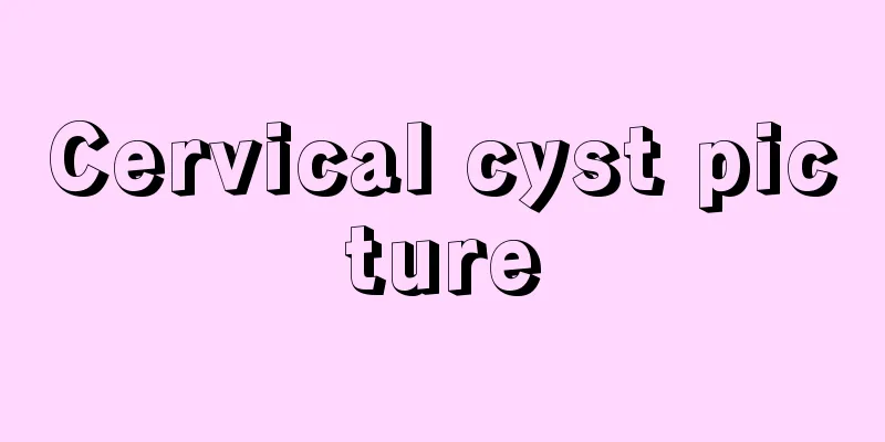 Cervical cyst picture