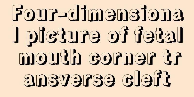 Four-dimensional picture of fetal mouth corner transverse cleft