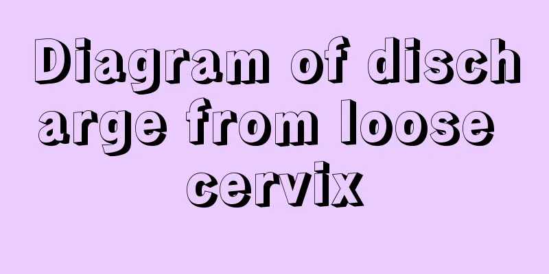 Diagram of discharge from loose cervix