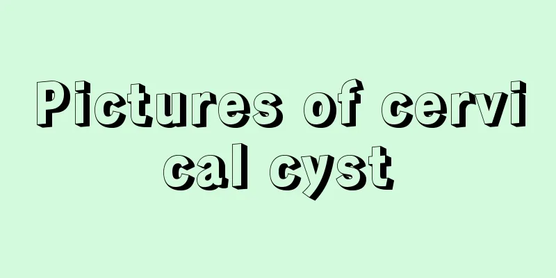 Pictures of cervical cyst