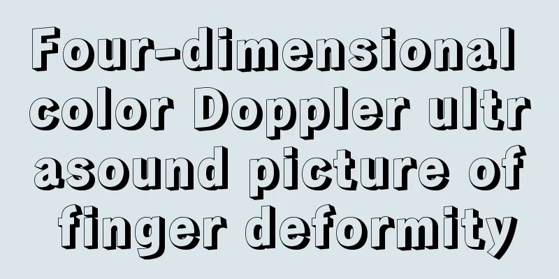 Four-dimensional color Doppler ultrasound picture of finger deformity