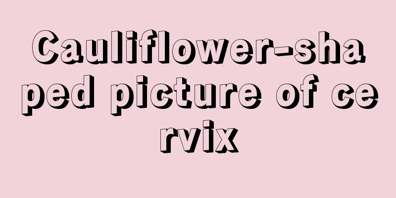 Cauliflower-shaped picture of cervix