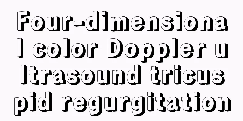 Four-dimensional color Doppler ultrasound tricuspid regurgitation