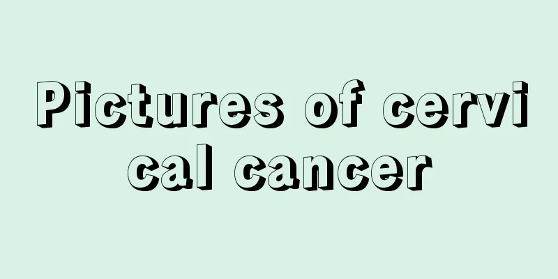 Pictures of cervical cancer