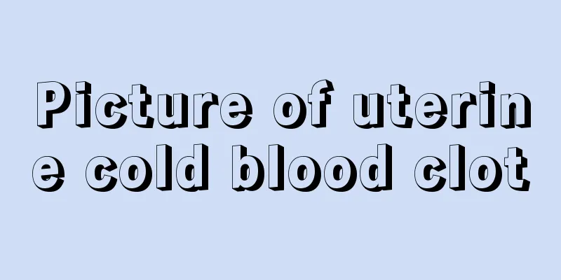 Picture of uterine cold blood clot