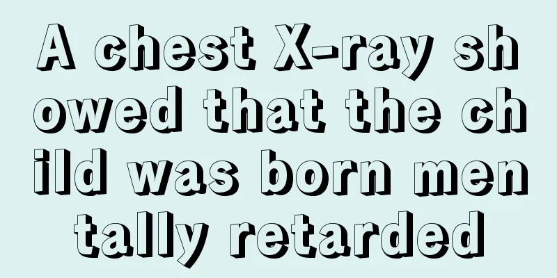 A chest X-ray showed that the child was born mentally retarded