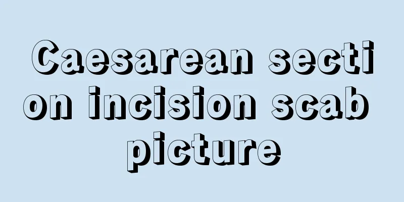 Caesarean section incision scab picture