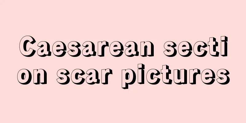 Caesarean section scar pictures