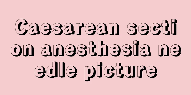 Caesarean section anesthesia needle picture