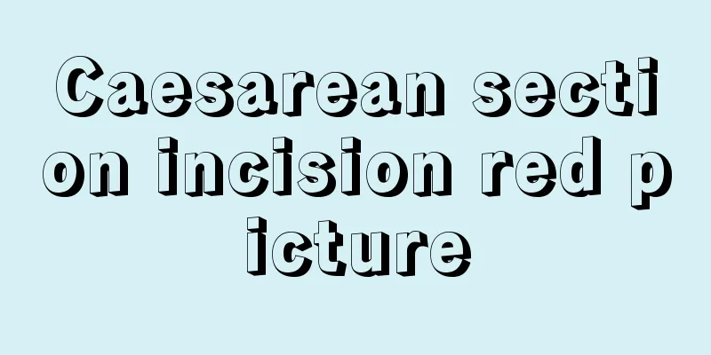 Caesarean section incision red picture