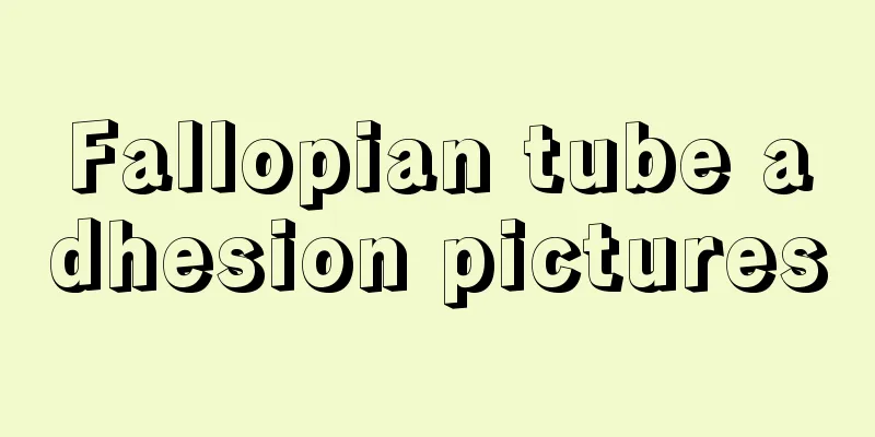 Fallopian tube adhesion pictures