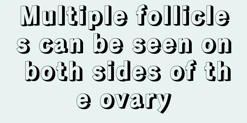 Multiple follicles can be seen on both sides of the ovary