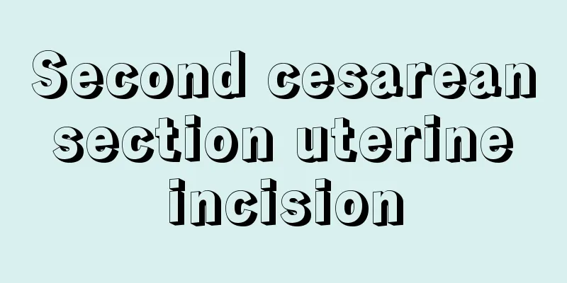 Second cesarean section uterine incision