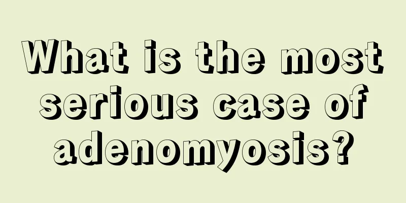 What is the most serious case of adenomyosis?