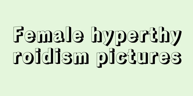 Female hyperthyroidism pictures