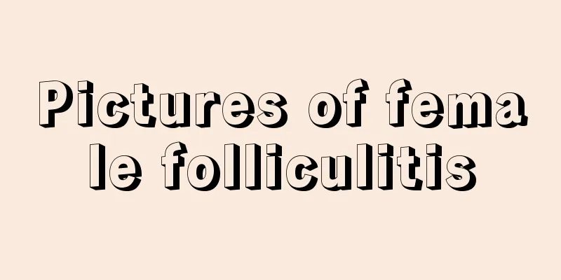 Pictures of female folliculitis