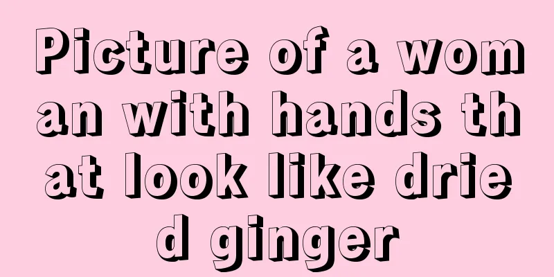 Picture of a woman with hands that look like dried ginger