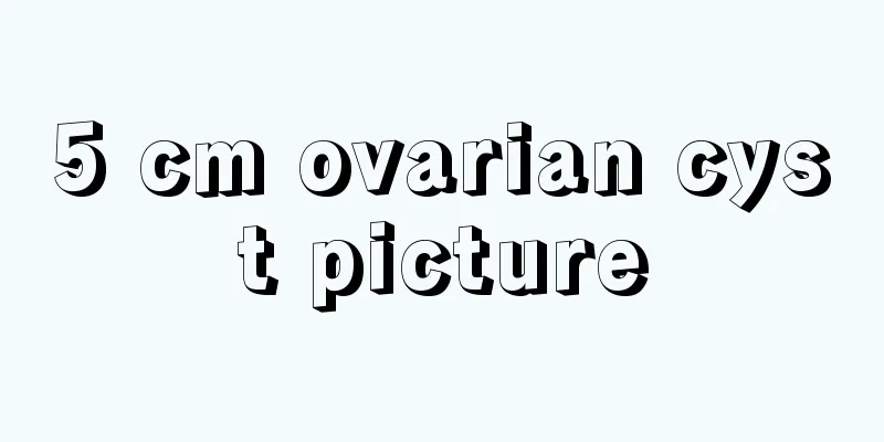 5 cm ovarian cyst picture