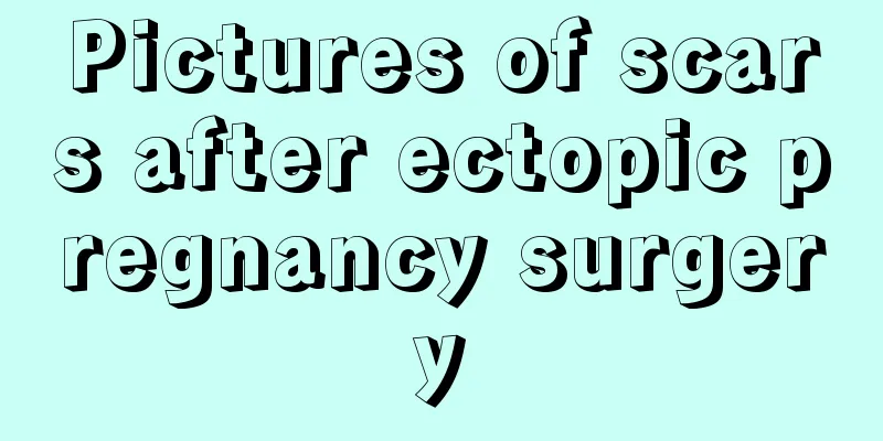 Pictures of scars after ectopic pregnancy surgery