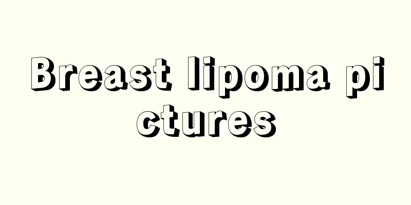 Breast lipoma pictures