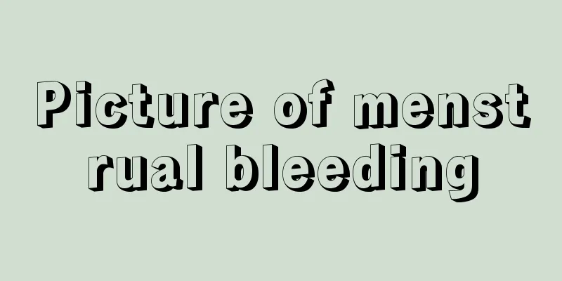 Picture of menstrual bleeding