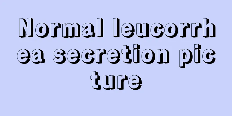 Normal leucorrhea secretion picture