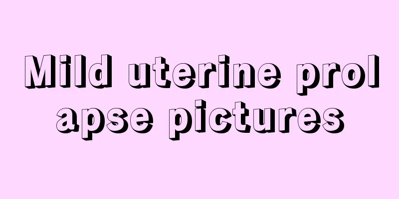 Mild uterine prolapse pictures